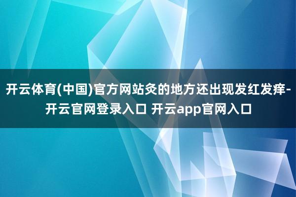 开云体育(中国)官方网站灸的地方还出现发红发痒-开云官网登录入口 开云app官网入口